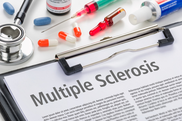 Cannabis and MS text