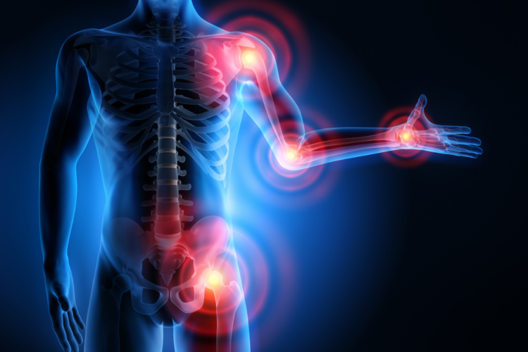 Cannabis for Inflammation 1
